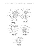 SOFT TISSUE REPAIR APPARATUS AND METHOD diagram and image