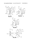 SOFT TISSUE REPAIR APPARATUS AND METHOD diagram and image