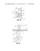 SOFT TISSUE REPAIR APPARATUS AND METHOD diagram and image