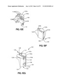 SOFT TISSUE REPAIR APPARATUS AND METHOD diagram and image