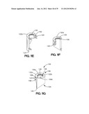 SOFT TISSUE REPAIR APPARATUS AND METHOD diagram and image