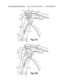 SOFT TISSUE REPAIR APPARATUS AND METHOD diagram and image