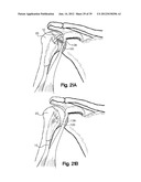 SOFT TISSUE REPAIR APPARATUS AND METHOD diagram and image