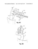 SOFT TISSUE REPAIR APPARATUS AND METHOD diagram and image