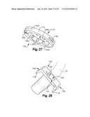 SOFT TISSUE REPAIR APPARATUS AND METHOD diagram and image