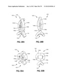 SOFT TISSUE REPAIR APPARATUS AND METHOD diagram and image