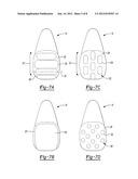 Pyrocarbon Orthopedic Implant diagram and image