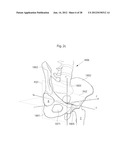 HIP JOINT DEVICE AND METHOD diagram and image