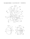 HIP JOINT DEVICE AND METHOD diagram and image