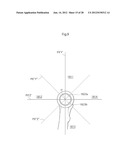 HIP JOINT DEVICE AND METHOD diagram and image