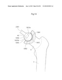 HIP JOINT DEVICE AND METHOD diagram and image