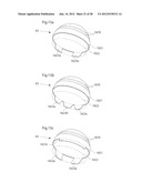 HIP JOINT DEVICE AND METHOD diagram and image