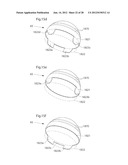 HIP JOINT DEVICE AND METHOD diagram and image