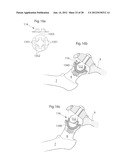 HIP JOINT DEVICE AND METHOD diagram and image