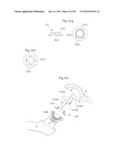 HIP JOINT DEVICE AND METHOD diagram and image