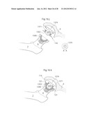 HIP JOINT DEVICE AND METHOD diagram and image