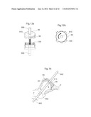 MEDICAL DEVICE AND METHOD FOR TREATMENT OF HIP JOINT diagram and image