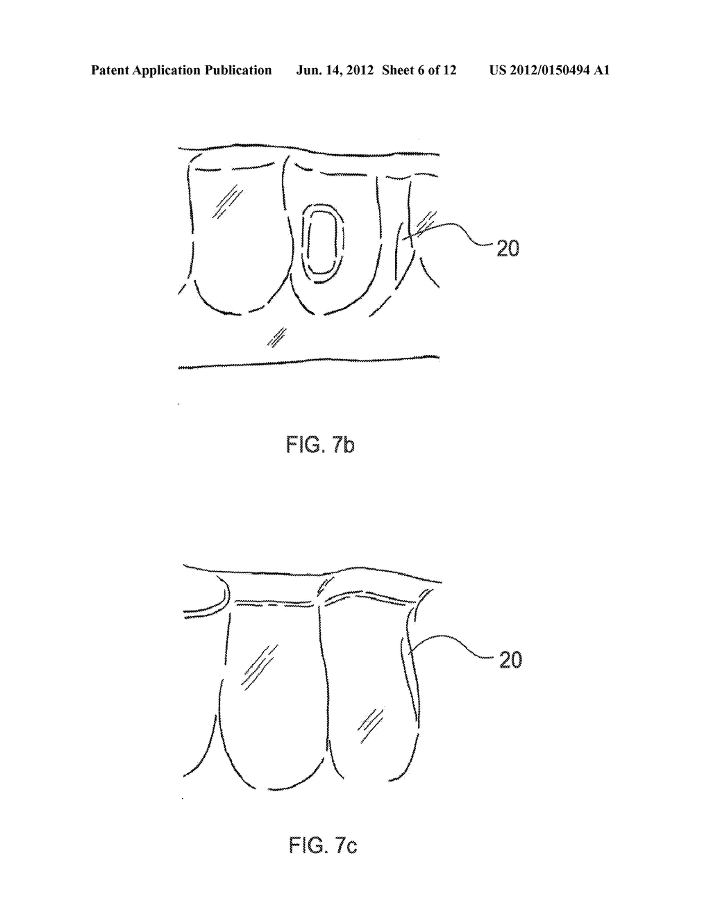 ORTHODONTIC ALIGNER FABRICATION BY OVERLAY METHOD - diagram, schematic, and image 07