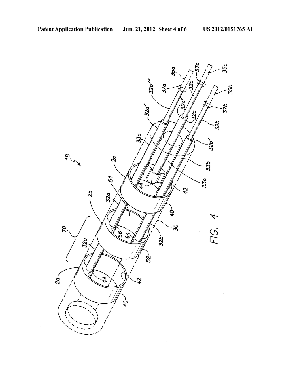 LEAD CONNECTOR END WITH INTEGRATED SHUNT - diagram, schematic, and image 05
