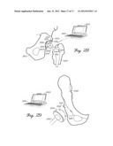 SMALL FORM FACTOR MEDICAL SENSOR STRUCTURE AND METHOD THEREFOR diagram and image