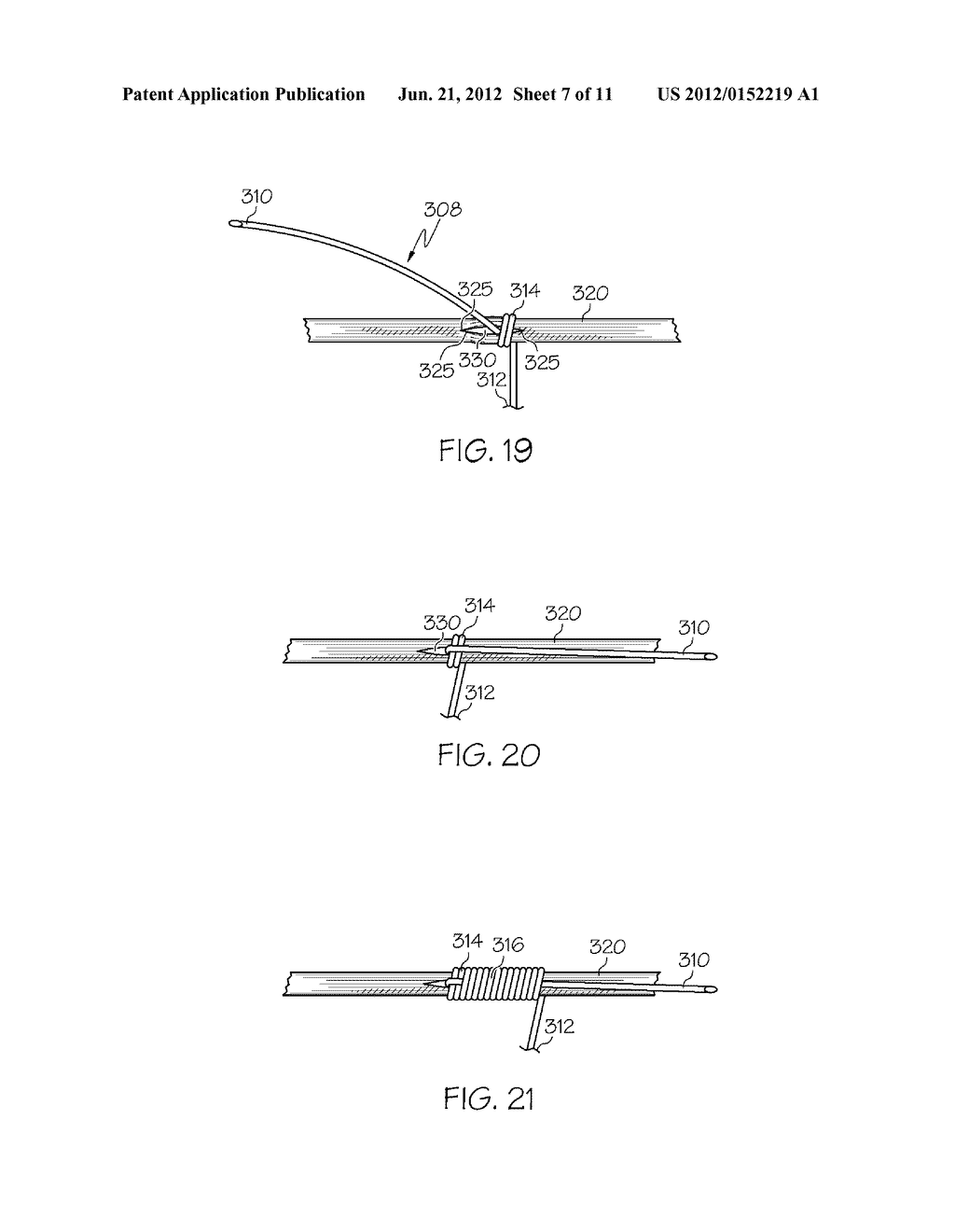 Surprisingly Superior Crossbow Serving - diagram, schematic, and image 08