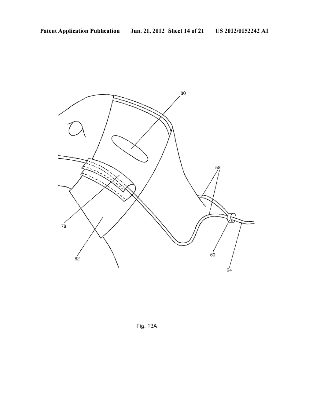 METHOD AND APPARATUS FOR PORTABLE FLUID DELIVERY FOR ANIMALS - diagram, schematic, and image 15