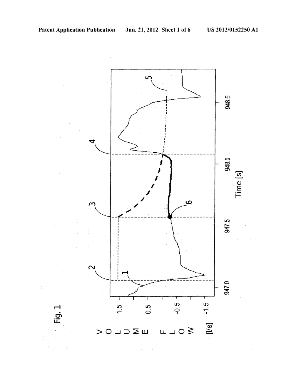 PROCESS FOR THE AUTOMATIC CONTROL OF A RESPIRATOR - diagram, schematic, and image 02