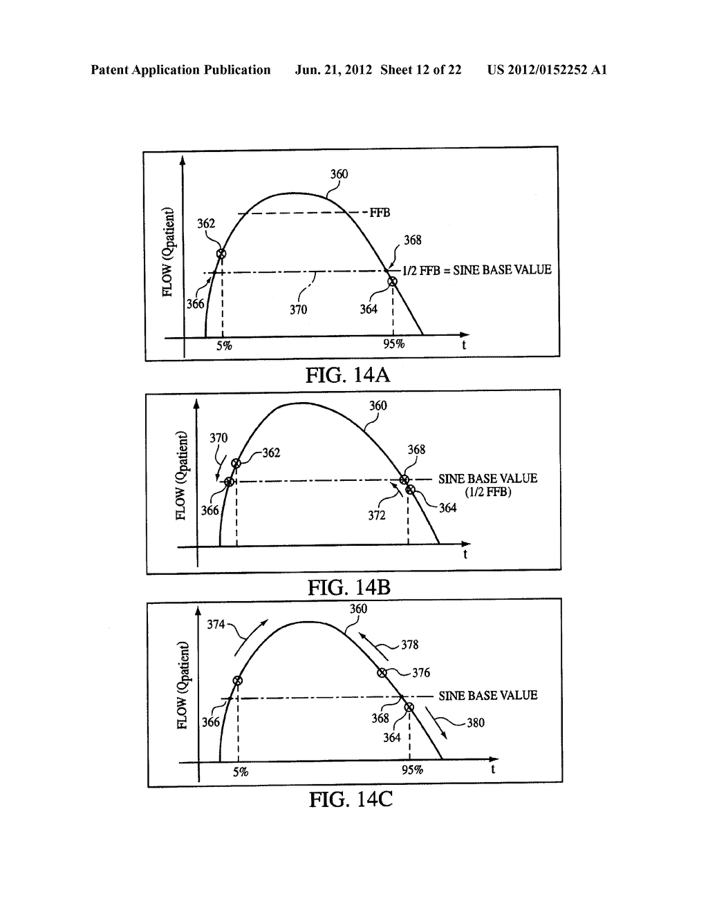 AUTO-TITRATION BI-LEVEL PRESSURE SUPPORT SYSTEM AND METHOD OF USING SAME - diagram, schematic, and image 13