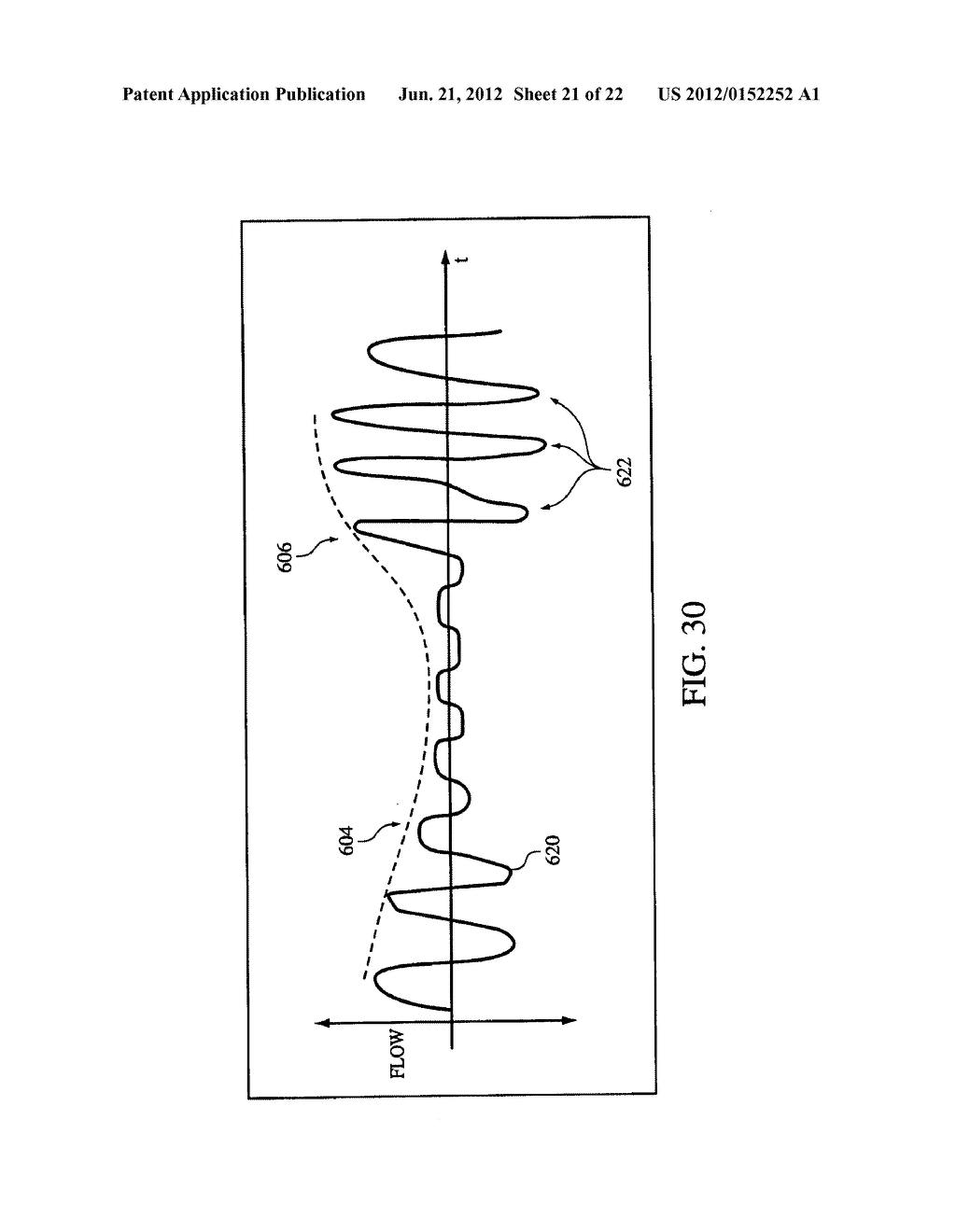 AUTO-TITRATION BI-LEVEL PRESSURE SUPPORT SYSTEM AND METHOD OF USING SAME - diagram, schematic, and image 22