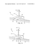 RESTRAINT STSTEM FOR AN ENERGY STORAGE DEVICE diagram and image