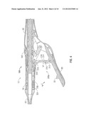 SURGICAL INSTRUMENT WITH SAFETY MECHANISM diagram and image