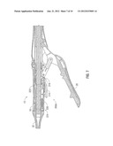 SURGICAL INSTRUMENT WITH SAFETY MECHANISM diagram and image