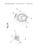 WIRELESS ENERGY TRANSFER ACROSS VARIABLE DISTANCES USING FIELD SHAPING     WITH MAGNETIC MATERIALS TO IMPROVE THE COUPLING FACTOR diagram and image