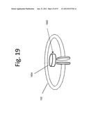 WIRELESS ENERGY TRANSFER ACROSS VARIABLE DISTANCES USING FIELD SHAPING     WITH MAGNETIC MATERIALS TO IMPROVE THE COUPLING FACTOR diagram and image