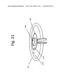 WIRELESS ENERGY TRANSFER ACROSS VARIABLE DISTANCES USING FIELD SHAPING     WITH MAGNETIC MATERIALS TO IMPROVE THE COUPLING FACTOR diagram and image