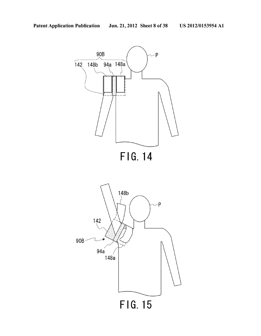 RF COIL DEVICE AND MAGNETIC RESONANCE IMAGING APPARATUS - diagram, schematic, and image 09