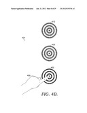 Contrast Sensitivity Testing And/Or Training Using Circular Contrast Zones diagram and image