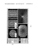 QUANTITATIVE ENDOSCOPY diagram and image