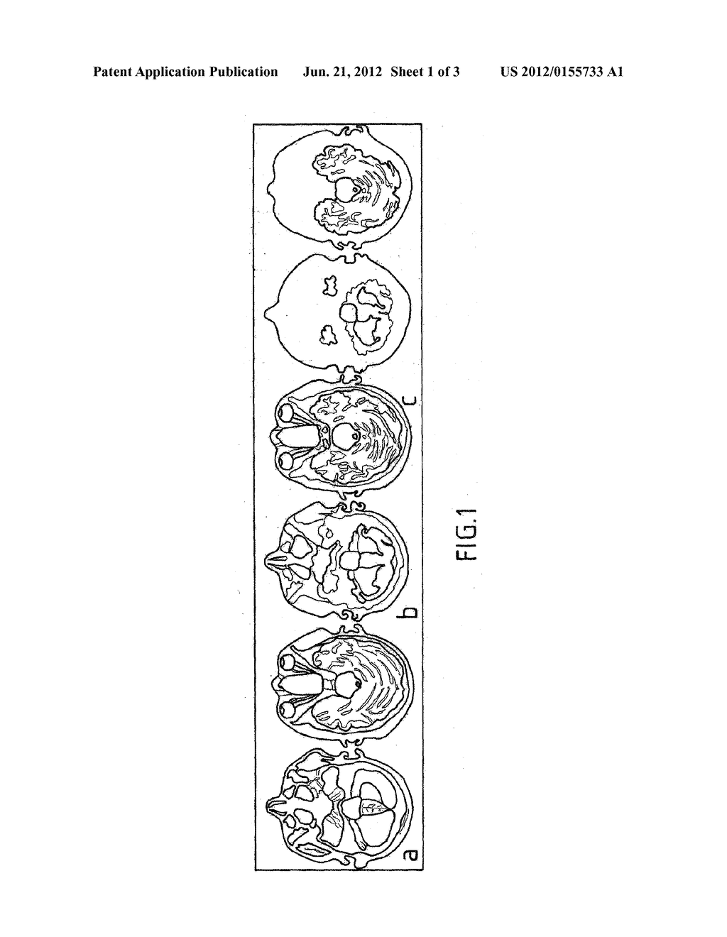 KNOWLEDGE-BASED SEGMENTATION OF ATTENUATION-RELEVANT REGIONS OF THE HEAD - diagram, schematic, and image 02