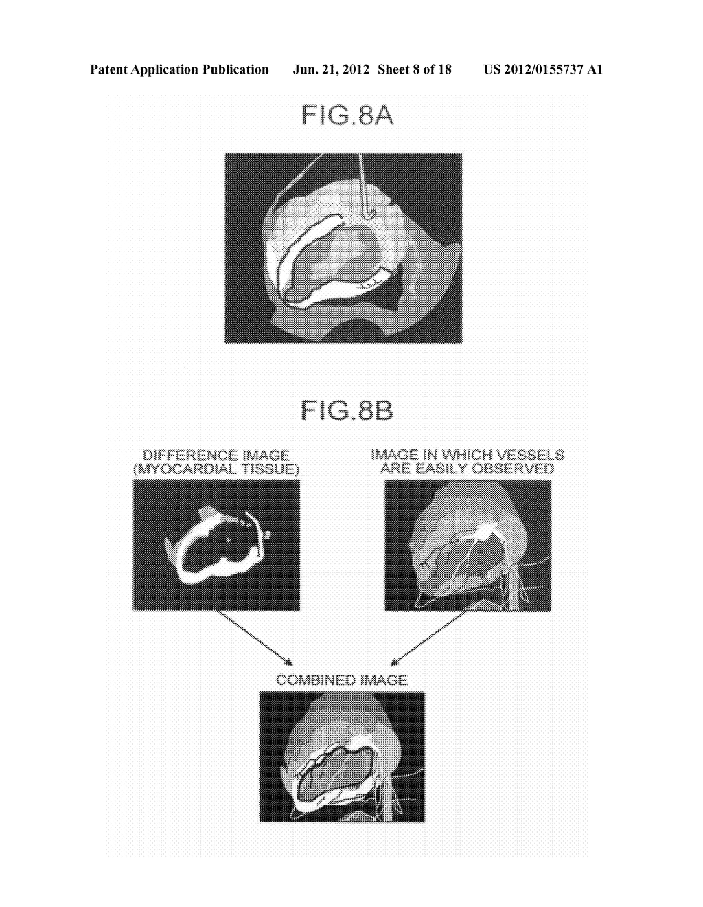 IMAGE PROCESSING APPARATUS AND IMAGE PROCESSING METHOD - diagram, schematic, and image 09