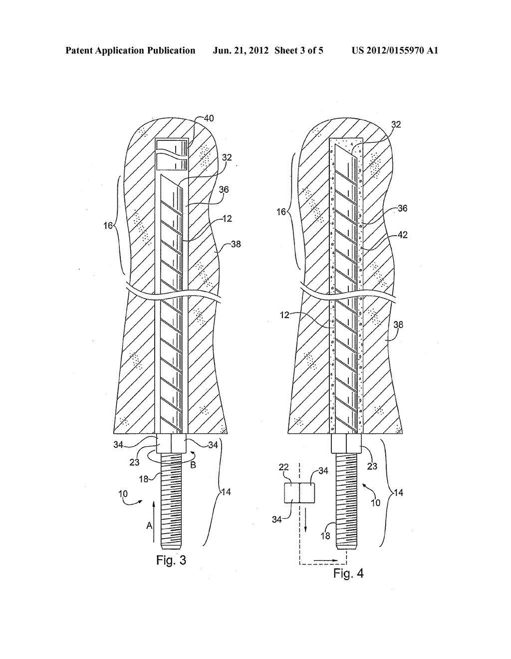 Mine Roof Bolt With End Fitting - diagram, schematic, and image 04