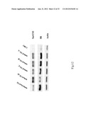 SORCS1-LIKE AGENT FOR USE IN THE TREATMENT OF INSULIN RESISTANCE AND     DISEASES RELATED THERETO diagram and image