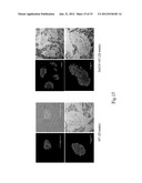 SORCS1-LIKE AGENT FOR USE IN THE TREATMENT OF INSULIN RESISTANCE AND     DISEASES RELATED THERETO diagram and image