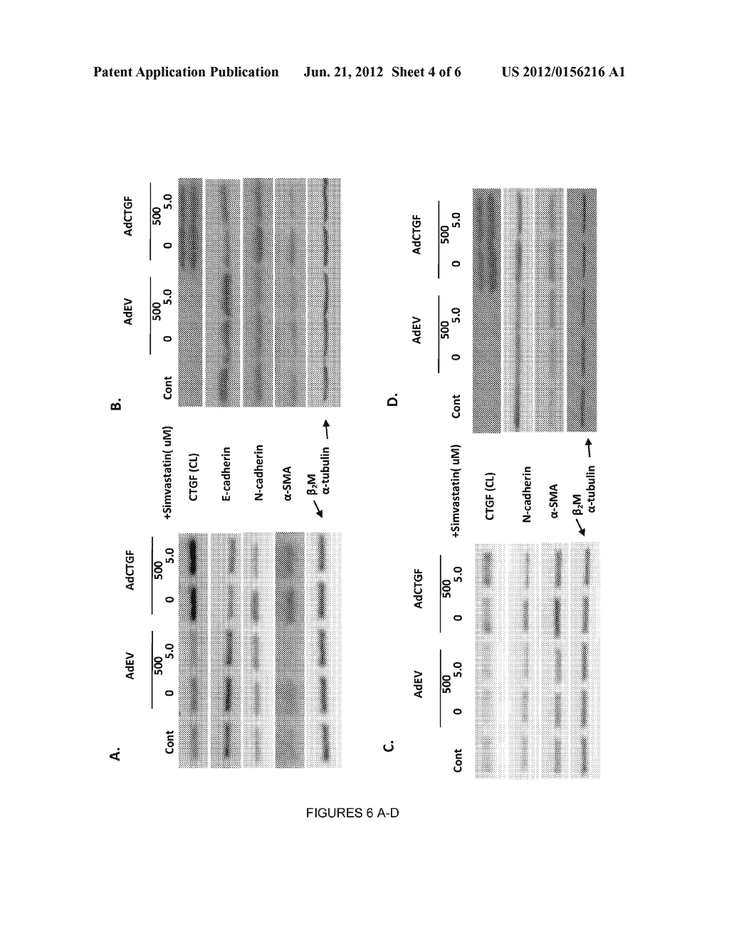 Methods and Compositions for Treatment of Tumor Metastasis - diagram, schematic, and image 05