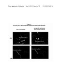 Methods and Compositions for Wound Treatment diagram and image