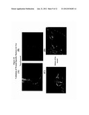 Methods and Compositions for Wound Treatment diagram and image