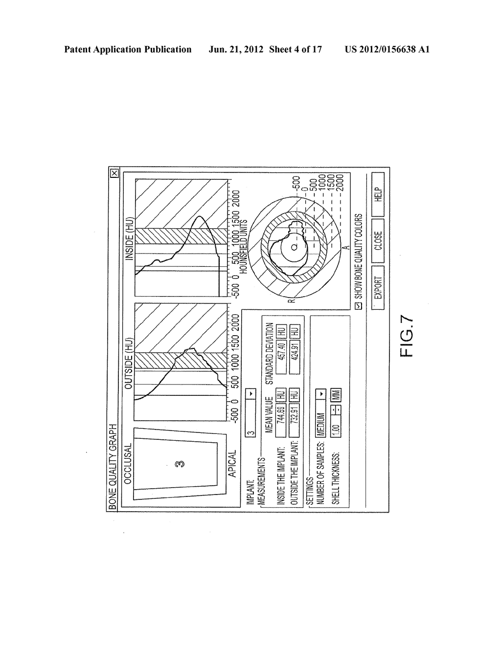 ASSISTED DENTAL IMPLANT TREATMENT - diagram, schematic, and image 05