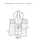 SYSTEM AND METHOD FOR PREVENTION AND TREATMENT OF PERI-IMPLANT INFECTION diagram and image