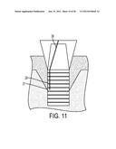 SYSTEM AND METHOD FOR PREVENTION AND TREATMENT OF PERI-IMPLANT INFECTION diagram and image