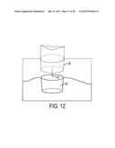 SYSTEM AND METHOD FOR PREVENTION AND TREATMENT OF PERI-IMPLANT INFECTION diagram and image